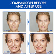 firming-facial-botox-serum-fight-aging-6254