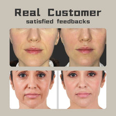 revolutionary-anti-aging-tech-bboji-facial-mask-zeroing-in-on-nasolabial-lines-6314